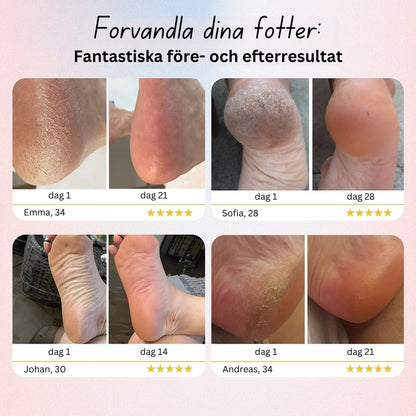 Elektrisk Fotfil